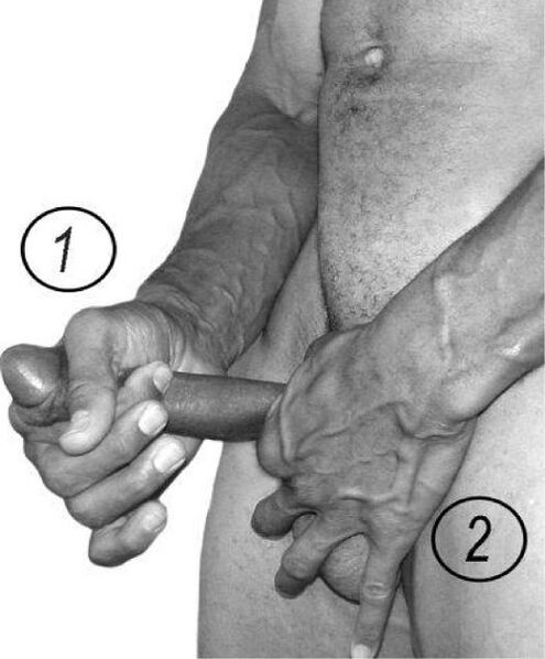 Stretching members to increase