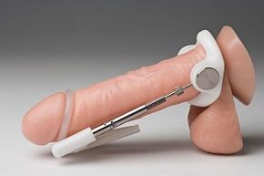 type of penis enlargement surgery
